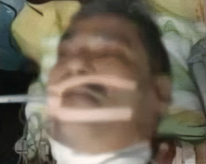 धनबाद में कोयला कारोबारी को घर में लगी गोली, हालत नाजुक; पुलिस जांच में जुटी